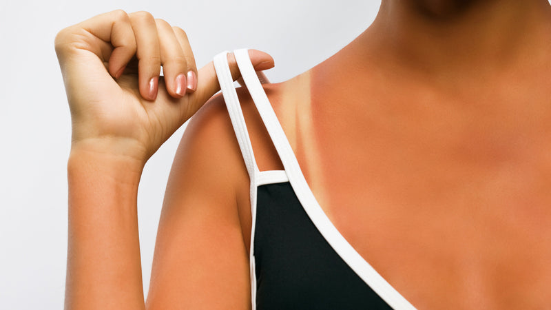 Te lang in de zon, wat doet dat met je huid | Advies | Dermatheek