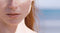 Check Je Vlekje En Plekje | Dè Avène Specialist | Dermatheek
