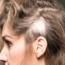 TRIX Basic TRIX Basic Gamma - bij haarverlies door alopecia areata Dermatheek